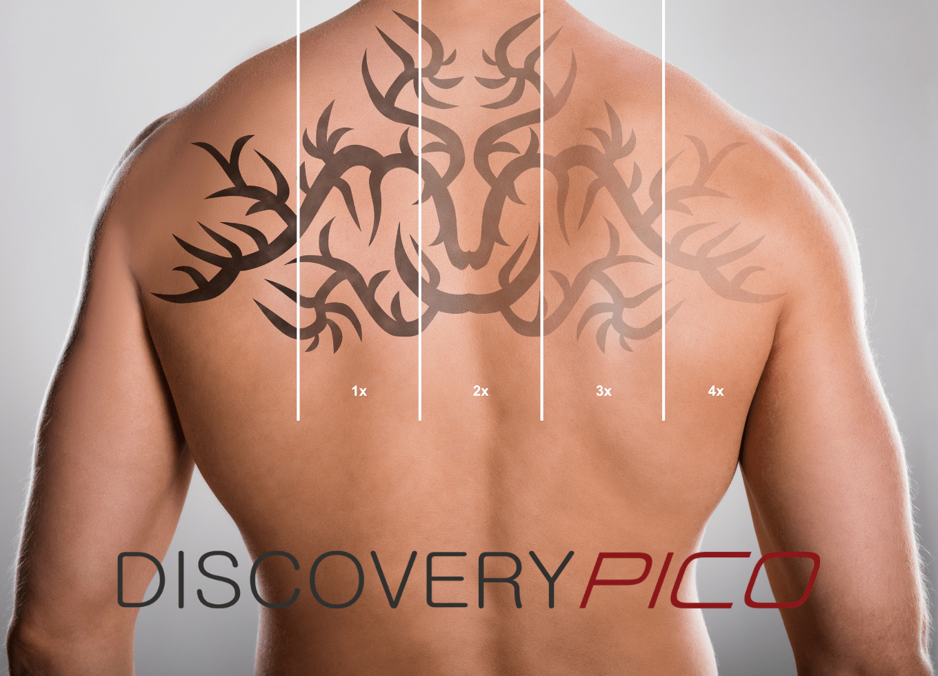 Effective Laser Tattoo Removal | Augusta Laser Experts