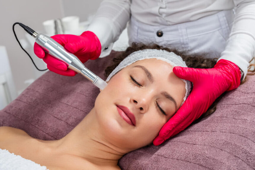 PRX DermPerfexion & Microneedling The perfect Duo at New Skin Medical Spa