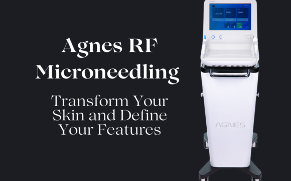 Agnes RF Microneedling at New Skin Medical Spa