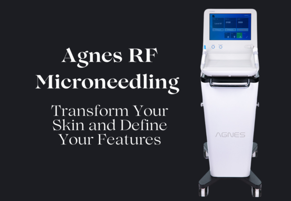 Agnes RF Microneedling at New Skin Medical Spa