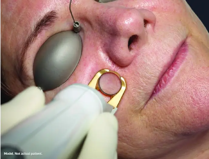 Facial skincare treatment illustration